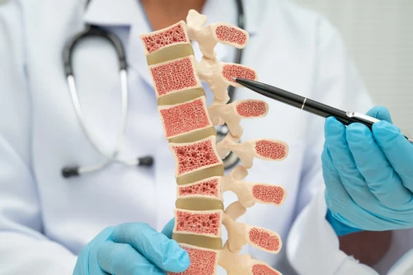 Bezpłatne badania osteoporozy w Ryczywole – zapisy trwają